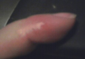 finger
